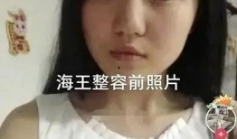 网红吃瓜黑历史是真的吗,真相揭秘与争议分析